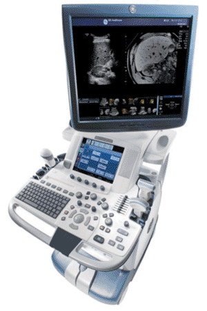 Imagen A: El sistema de ultrasonido LOGIQ E9 (Foto cortesía de GE Healthcare). Imagen A: El sistema de ultrasonido LOGIQ E9 (Foto cortesía de GE Healthcare).